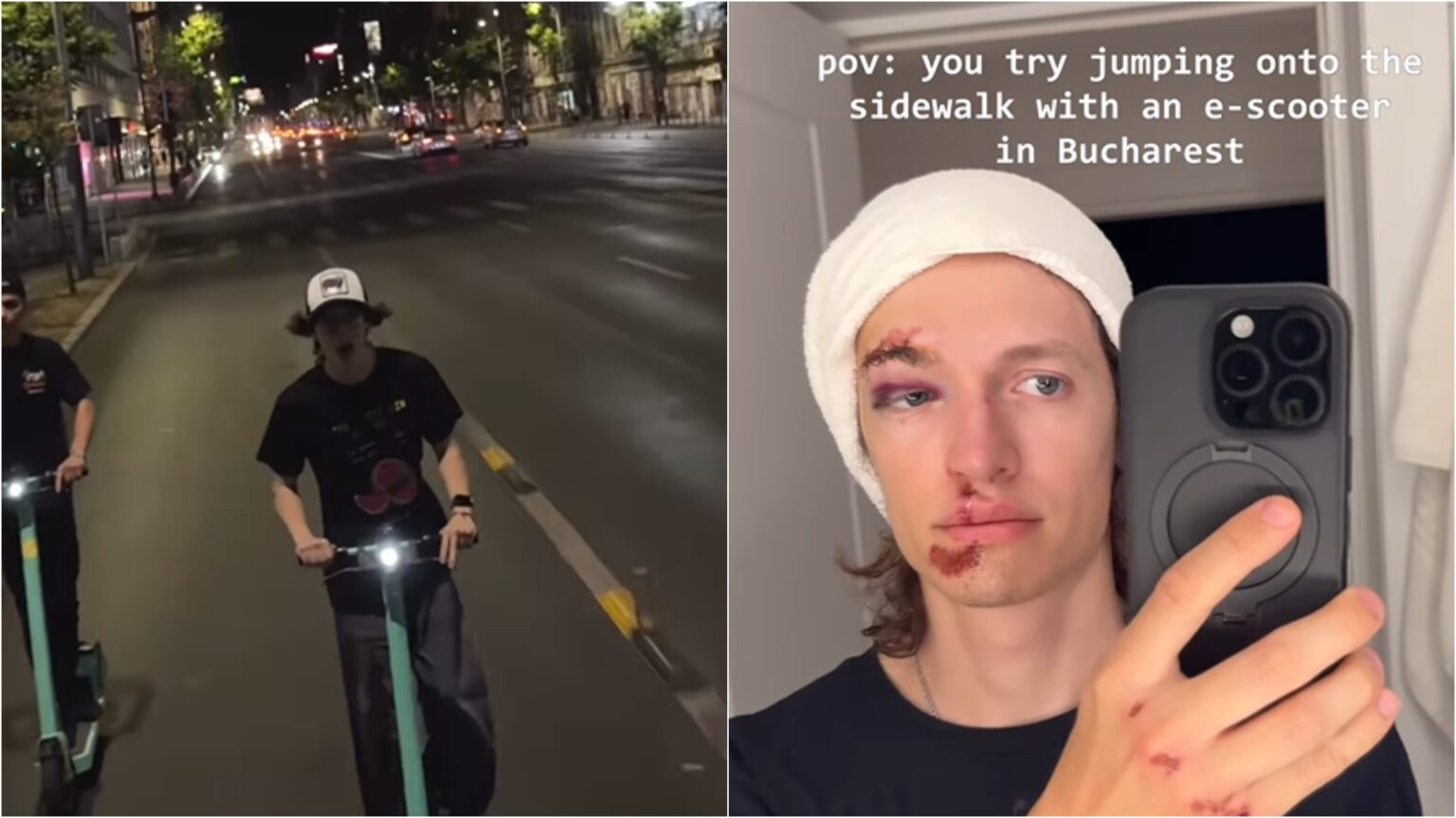 video edsta influencerul s a accidentat grav dupa ce a cazut de pe trotineta in centru capitalei am vrut sa sar o bordura si eu am zburat direct pe asfalt 68b997e5e360c