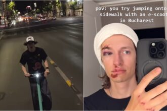 video edsta influencerul s a accidentat grav dupa ce a cazut de pe trotineta in centru capitalei am vrut sa sar o bordura si eu am zburat direct pe asfalt 68b997e5e360c