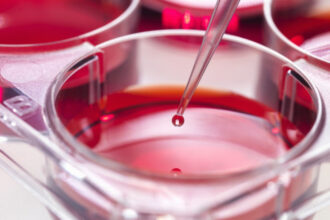 oamenii de stiinta au identificat un potential mecanism de blocare a unei forme agresive de leucemie 699be9f8b1392