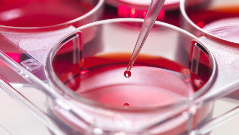 oamenii de stiinta au identificat un potential mecanism de blocare a unei forme agresive de leucemie 699be9f8b1392