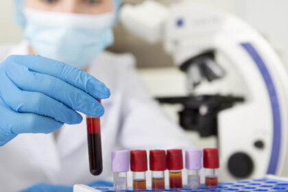 simptomele intoxicatiei cu metale grele explicate de toxicolog expunerea la arsenic poate provoca tulburari neurologice severe 6982dd7da1d7b