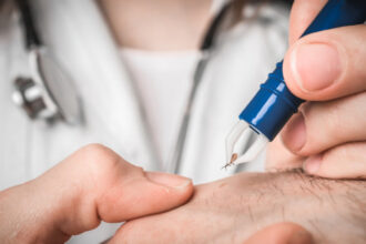 capusele pericolul ascuns al verii medicii infectionisti explica ce boli transmit si cum recunosti rapid semnele muscaturii 69f2ded988862
